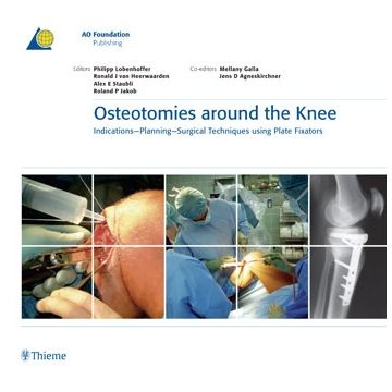 Osteotomies around the Knee. Indications-Planning-Surgical Techniques using Plate Fixators  Lobenhoffer Philipp; van Heerwaarden Ronald J.; Staubli Alex E.; Jakob Roland Peter  Thieme Medical Publishers  9783131475312