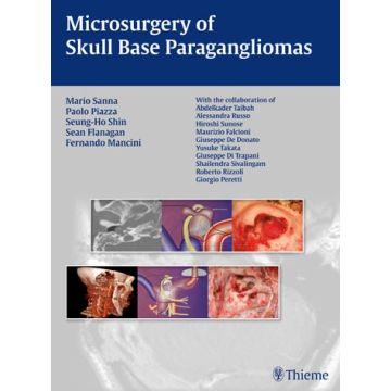 Microsurgery of Skull Base Paragangliomas  Sanna Mario; Shin Seung-Ho; Flanagan Sean P.; Mancini Fernando; Piazza Paolo  Thieme Medical Publishers  9783131486110
