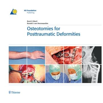 Osteotomies for Posttraumatic Deformities  Marti René K.; van Heerwaarden Ronald J.  Thieme Medical Publishers  9783131486714