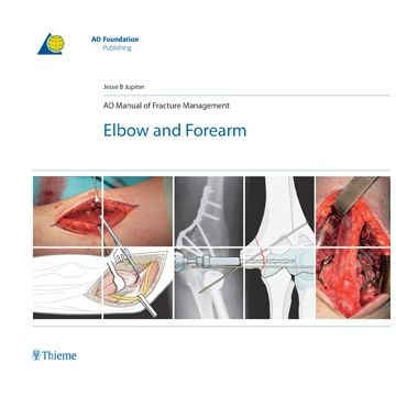 AO Manual of Fracture Management: Elbow & Forearm  Jupiter Jesse B.  Thieme Medical Publishers  9783131492715