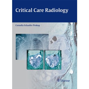 Critical Care Radiology  Schaefer-Prokop Cornelia  Thieme Medical Publishers  9783131500519