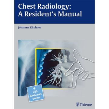 Chest Radiology: A Resident's Manual  Kirchner Johannes  Thieme Medical Publishers  9783131538710