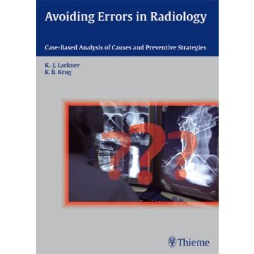 Avoiding Errors in Radiology. Case-Based Analysis of Causes and Preventive Strategies  Lackner Klaus-Juergen; Krug Kathrin Barbara  Thieme Medical Publishers  9783131538819