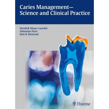 Caries Management - Science and Clinical Practice  Meyer-lueckel Hendrik; Paris Sebastian; Ekstrand Kim R.  Thieme Medical Publishers  9783131547118