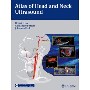 Atlas of Head and Neck Ultrasound  Iro Heinrich; Zenk Johannes; Bozzato Alessandro  Thieme Medical Publishers  9783131603517