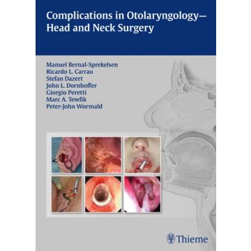 Complications in Otolaryngology-Head and Neck Surgery  Bernal-Sprekelsen Manuel; Carrau Ricardo L.; Dazert Stefan; Dornhoffer John L.; Peretti Giorgio; Tewfik Marc A.; Wormald Peter-John  Thieme Medical Publishers  9783131605313