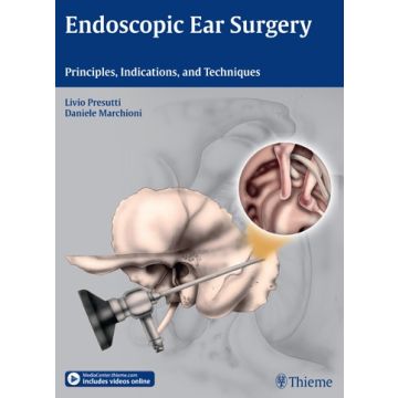 Endoscopic Ear Surgery. Principles, Indications, and Techniques  Presutti Livio; Marchioni Daniele  Thieme Medical Publishers  9783131630414