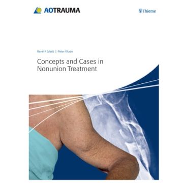Concepts and Cases in Nonunion Treatment  Marti René K.; Kloen Peter  Thieme Medical Publishers  9783131658517