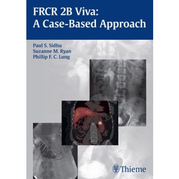 FRCR 2B Viva: A Case-based Approach  Sidhu Paul S.; Ryan Suzanne M.; Lung Phillip F. C.  Thieme Medical Publishers  9783131662910