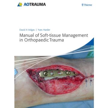 Manual of Soft-tissue Management in Orthopaedic Trauma  Volgas David A.; Harder Yves  Thieme Medical Publishers  9783131663719