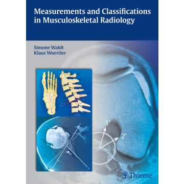 Measurements and Classifications in Musculoskeletal Radiology  Waldt Simone; Eiber Matthias; Woertler Klaus  Thieme Medical Publishers  9783131692719