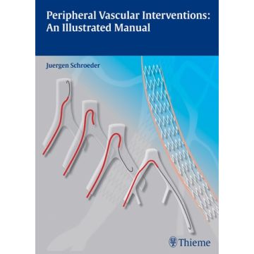 Peripheral Vascular Interventions: An Illustrated Manual  Schroeder Juergen  Thieme Medical Publishers  9783131697516