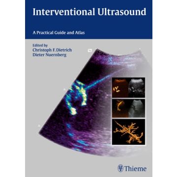 Interventional Ultrasound. A Practical Guide and Atlas  Dietrich Christoph Frank; Nuernberg Pieter  Thieme Medical Publishers  9783131708212