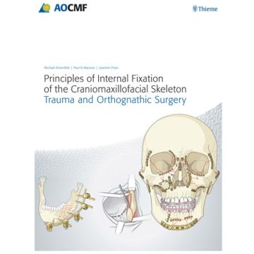 Principles of Internal Fixation of the Craniomaxillofacial Skeleton  Ehrenfeld Michael; Manson Paul N.; Prein Joachim  Thieme Medical Publishers  9783131714817