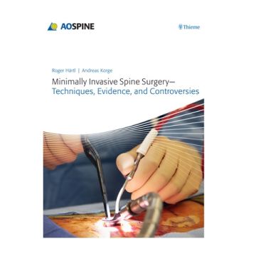 Minimally Invasive Spine Surgery. Techniques, Evidence, and Controversies  Haertl Roger; Korge Andreas  Thieme Medical Publishers  9783131723819