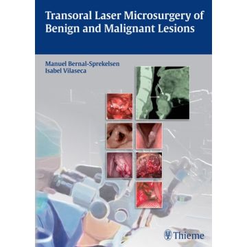 Transoral Laser Microsurgery of Benign and Malignant Lesions  Bernal-Sprekelsen Manuel; Vilaseca Isabel  Thieme Medical Publishers  9783131723918