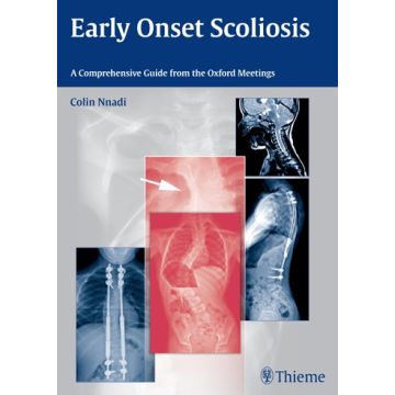 Early Onset Scoliosis. A Comprehensive Guide from the Oxford Meetings  Nnadi Colin  Thieme Medical Publishers  9783131726612