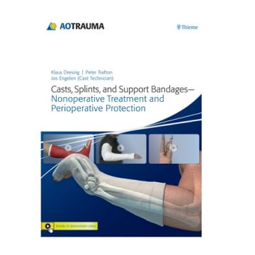 Casts, Splints, and Support Bandages. Nonoperative Treatment and Perioperative Protection  Dresing Klaus; Trafton Peter G.  Thieme Medical Publishers  9783131753410