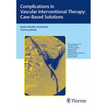 Complications in Vascular Interventional Therapy. Case-Based Solutions  Muller-Hulsbeck Stefan; Jahnke Thomas  Thieme Medical Publishers  9783131758316