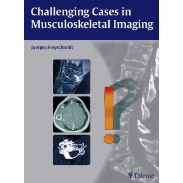 Challenging Cases in Musculoskeletal Imaging  Freyschmidt Jürgen  Thieme Medical Publishers  9783131764010