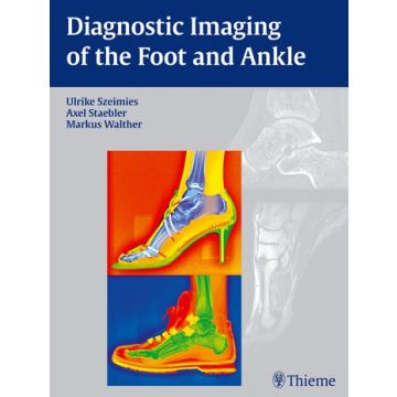 Diagnostic Imaging of the Foot and Ankle  Szeimies Ulrike; Stäbler Axel; Walther Markus  Thieme Medical Publishers  9783131764614