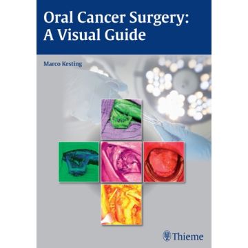 Oral Cancer Surgery: A Visual Guide  Kesting Marco R.  Thieme Medical Publishers  9783131994011