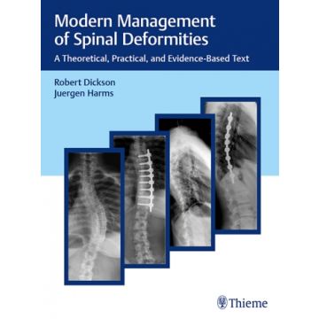 Modern Management of Spinal Deformities - A Theoretical, Practical, and Evidence-based Text     [Dickson - Thieme]