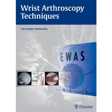 Wrist Arthroscopy Techniques  Mathoulin Christophe  Thieme Medical Publishers  9783132021815