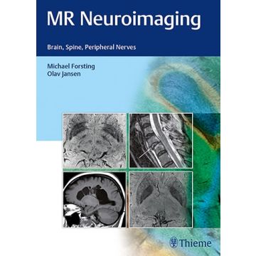 MR Neuroimaging - Brain, Spine, and Peripheral Nerves     [Jansen - Thieme]