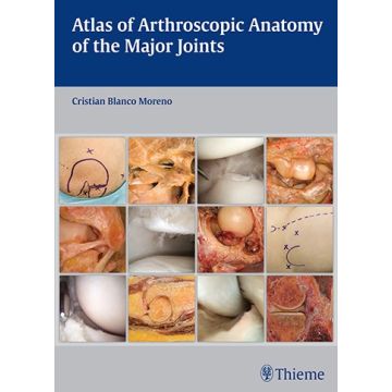Atlas of Arthroscopic Anatomy of Major Joints  Blanco Moreno Cristian  Thieme Medical Publishers  9783132037915