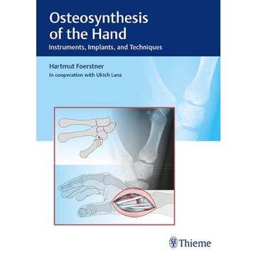 Osteosynthesis of the Hand - Instruments, Implants, and Techniques    [Forstner - Thieme]