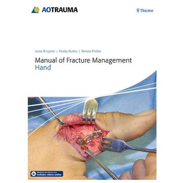 Manual of Fracture Management - Hand  Jupiter Jesse B.; Nunez Fiesky; Fricker Renato M.  Thieme Medical Publishers  9783132215818