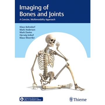 Imaging of Bones and Joints - A Concise, Multimodality Approach     [Bohndorf - Thieme]