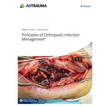 Principles of Orthopedic Infection Management      [Kates - Thieme]