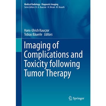 Imaging of Complications and Toxicity following Tumor Therapy  Kauczor Hans-Ulrich; Bäuerle Tobias  Springer Verlag  9783319128405