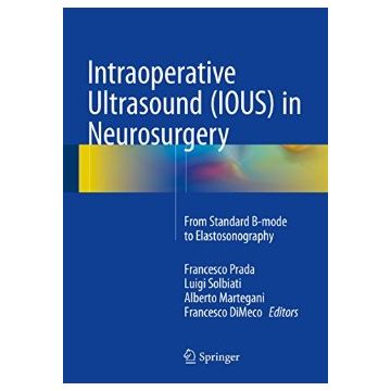 Intraoperative Ultrasound (IOUS) in Neurosurgery. From Standard B-mode to Elastosonography  Prada Francesco; Solbiati Luigi; Martegani Alberto; Dimeco Francesco  Springer Verlag  9783319252667