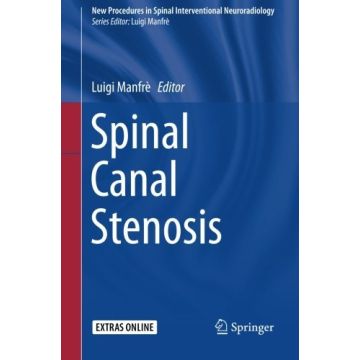Spinal Canal Stenosis  Manfrè Luigi  Springer Verlag  9783319262680