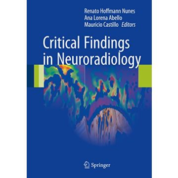 Critical Findings in Neuroradiology  Hoffmann Nunes Renato; Abello Ana Lorena; Castillo Mauricio  Springer Verlag  9783319279855