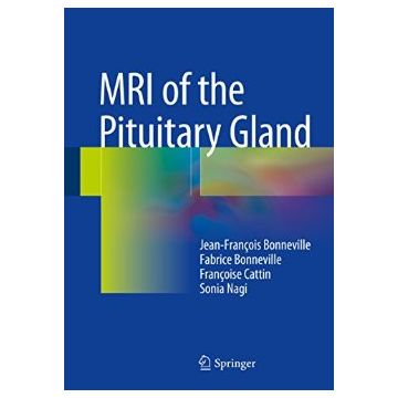 MRI of the Pituitary Gland  Bonneville Jean-Francois; Bonneville Fabrice; Cattin Francoise; Nagi Sonia  Springer Verlag  9783319290416