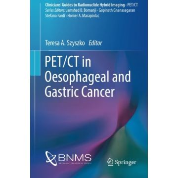 PET/CT in Oesophageal and Gastric Cancer  Szyszko Teresa  Springer Verlag  9783319292380