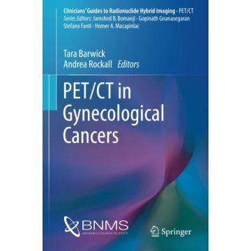 PET/CT in Gynecological Cancers  Barwick Tara; Rockall Andrea  Springer Verlag  9783319292472