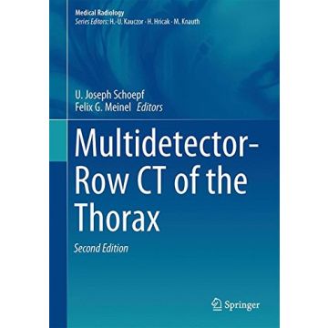Multidetector-Row CT of the Thorax  Schoepf U. Joseph; Meinel Felix G. Springer Verlag  9783319303536