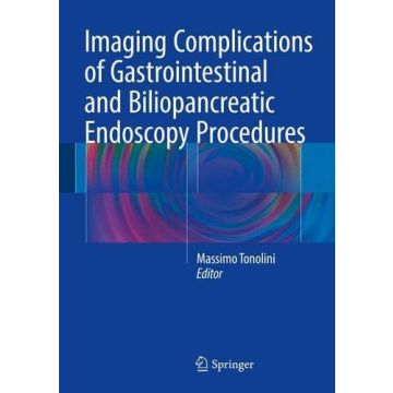 Imaging Complications of Gastrointestinal and Biliopancreatic Endoscopy Procedures  Tonolini Massimo  Springer Verlag  9783319312095