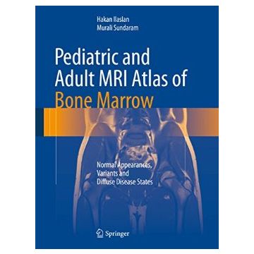 Pediatric and Adult MRI Atlas of Bone Marrow. Normal Appearances, Variants and Diffuse Disease States  Ilaslan Hakan; Sundaram Murali  Springer Verlag  9783642027390