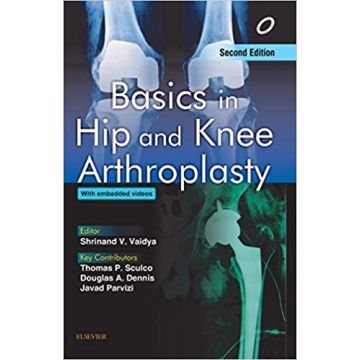 Basics in Hip and Knee Arthroplasty, 2nd Edition