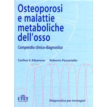 Osteoporosi e malattie metaboliche dell'osso Albanese Passariello 