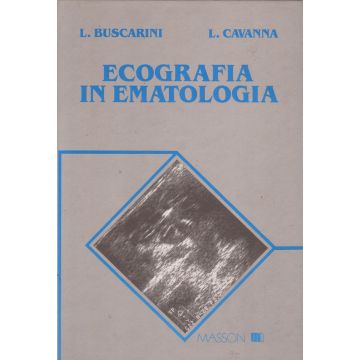 Ecografia in Ematologia [Buscarini  -  Elsevier Masson]
