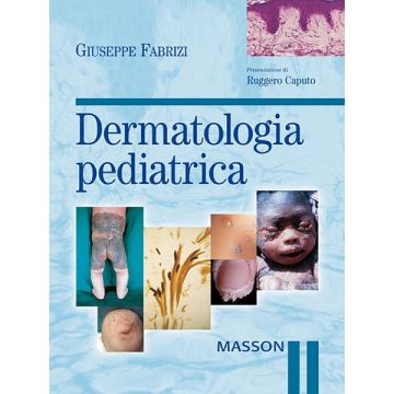 Fabrizi Dermatologia Pediatrica Masson