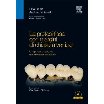 La protesi fissa con margini di chiusura verticali Ezio Bruna Fabianelli Elsevier Masson Edra