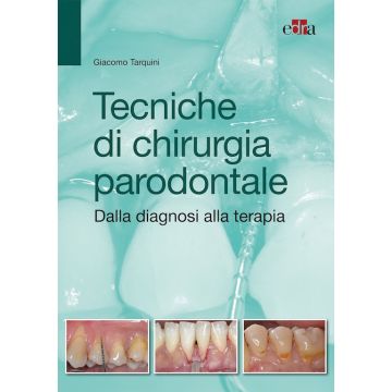 Tarquini Tecniche di chirurgia parodontale Edra Masson